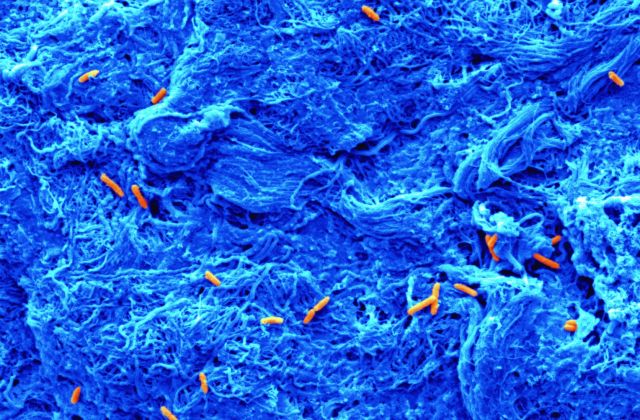 Bacteria growing on a collagen scaffold
