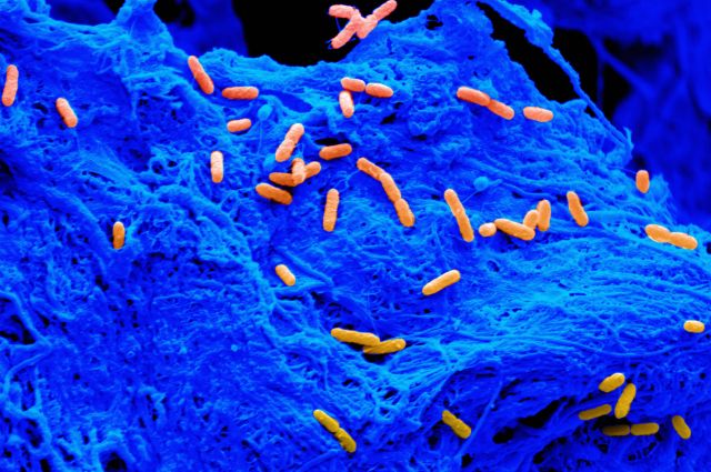 P. aeruginosa bacteria on mineralized collagen scaffold