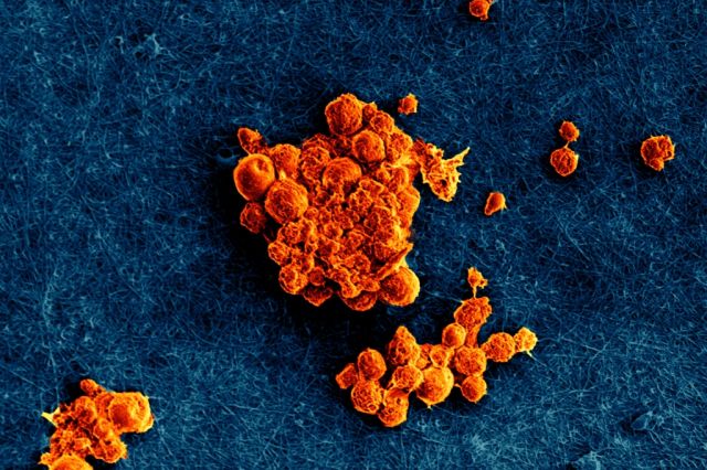SEM image of coral cells on collagen