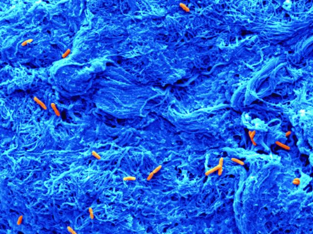 bacteria on collagen scaffold