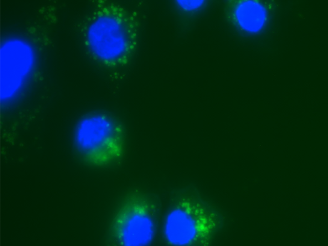SAOS-2 cells uptake MBV